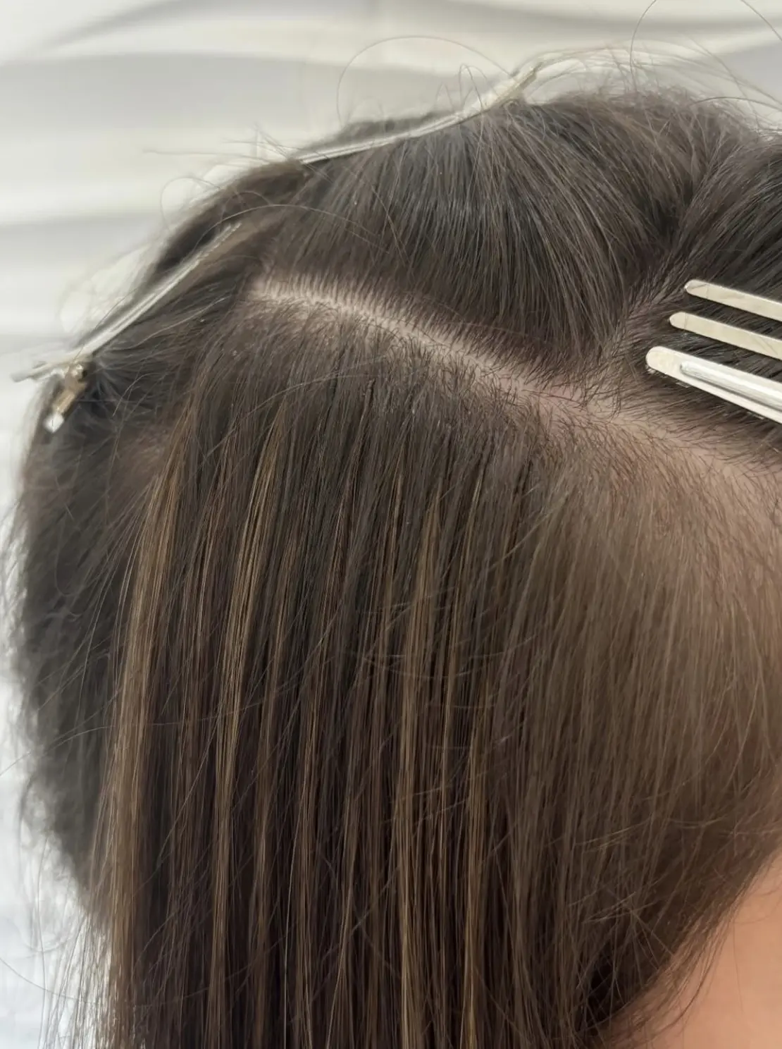 Detalle real de la colocación de extensiones